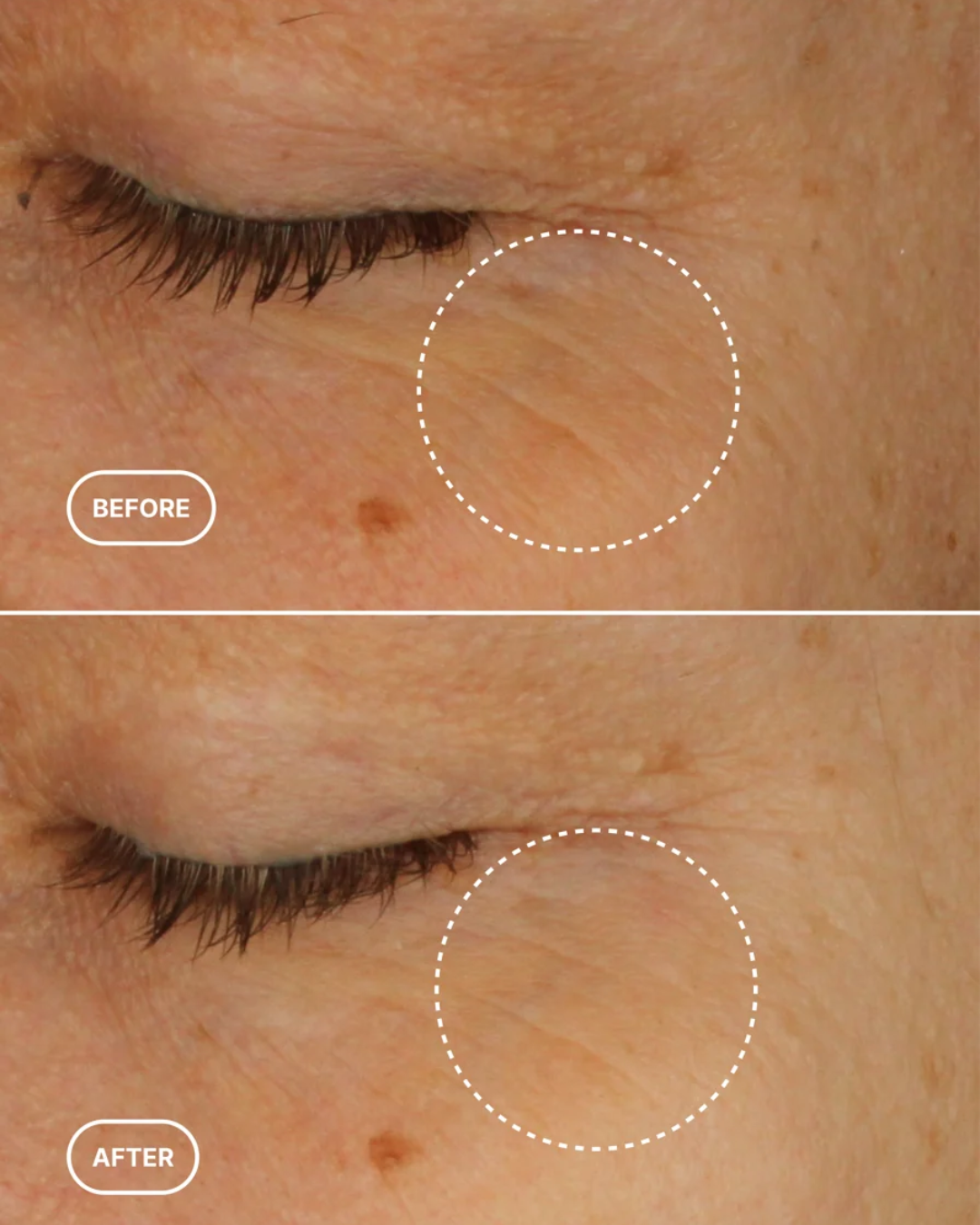 Ey – GENTLE EYE LIFT ☀︎