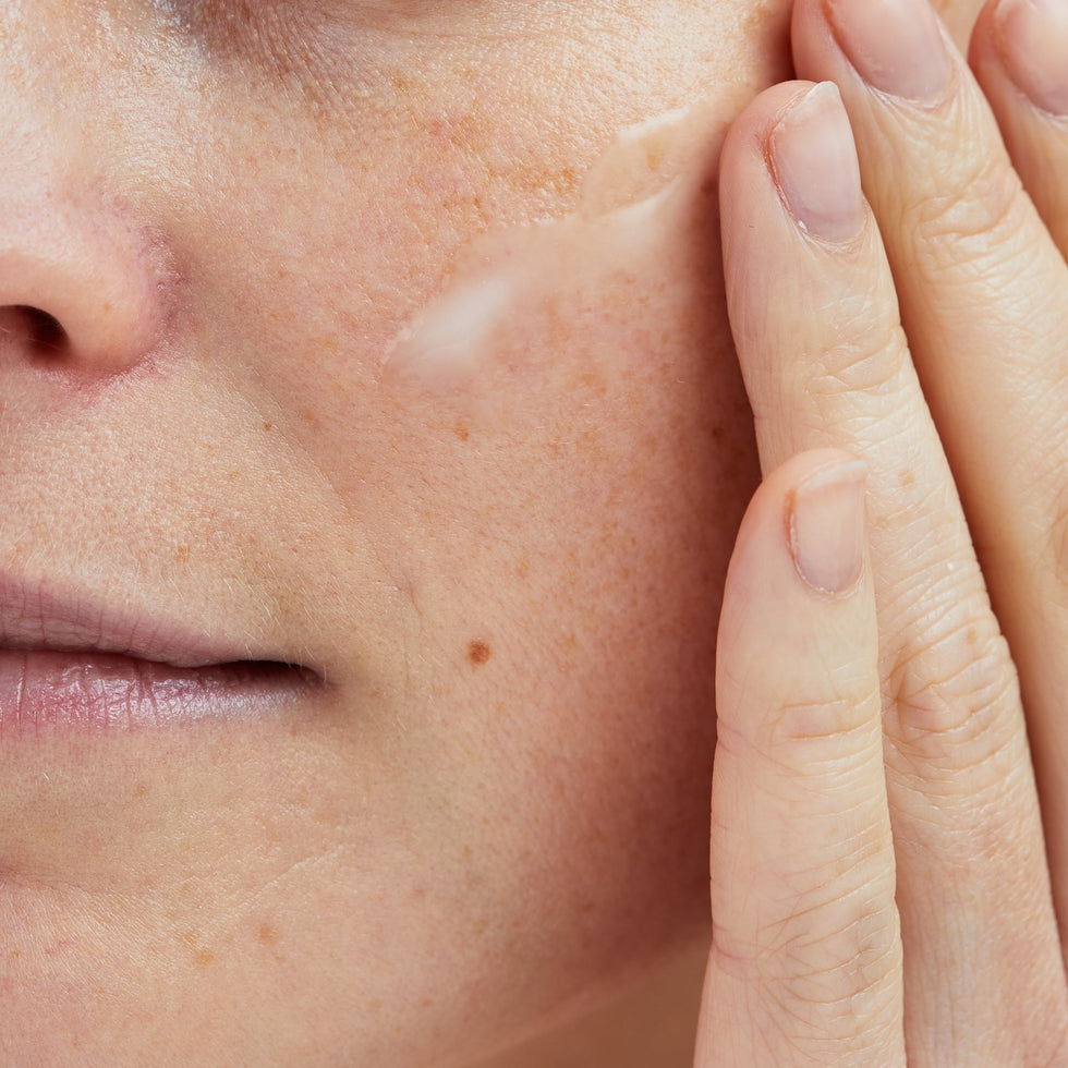 Warum fühlt sich deine Haut trocken an – selbst nach dem Eincremen?