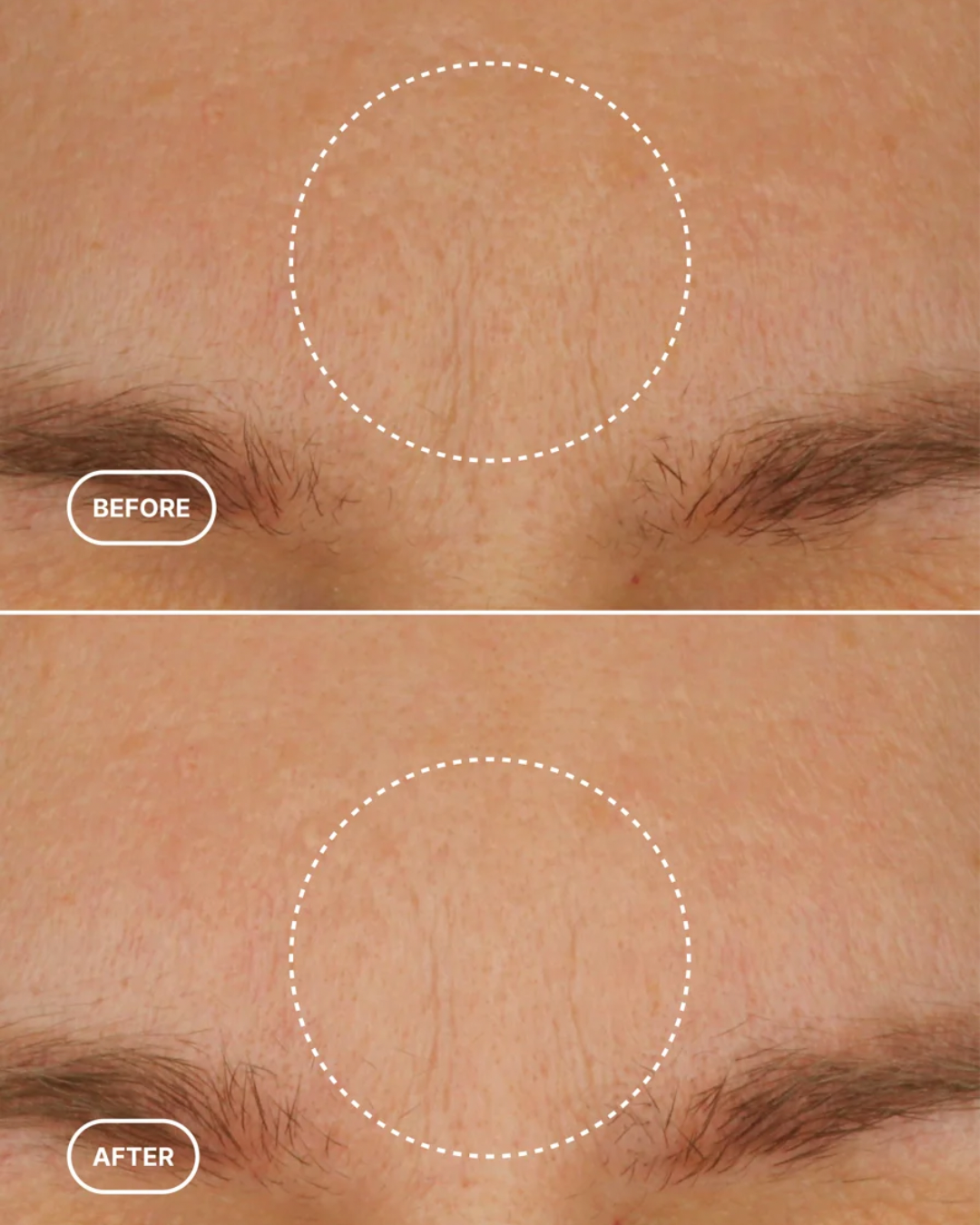 THE LIFTING PROTOCOL