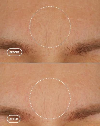 THE LIFTING PROTOCOL