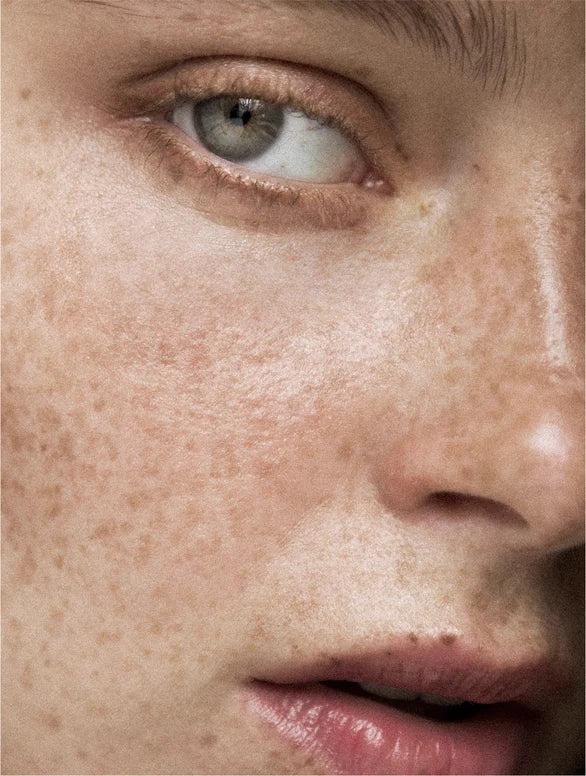 ANTI-SPOT SERUM – EVEN TONE & CLEAR SKIN™