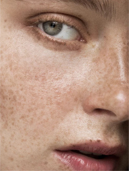 ANTI-SPOT SERUM – EVEN TONE & CLEAR SKIN™